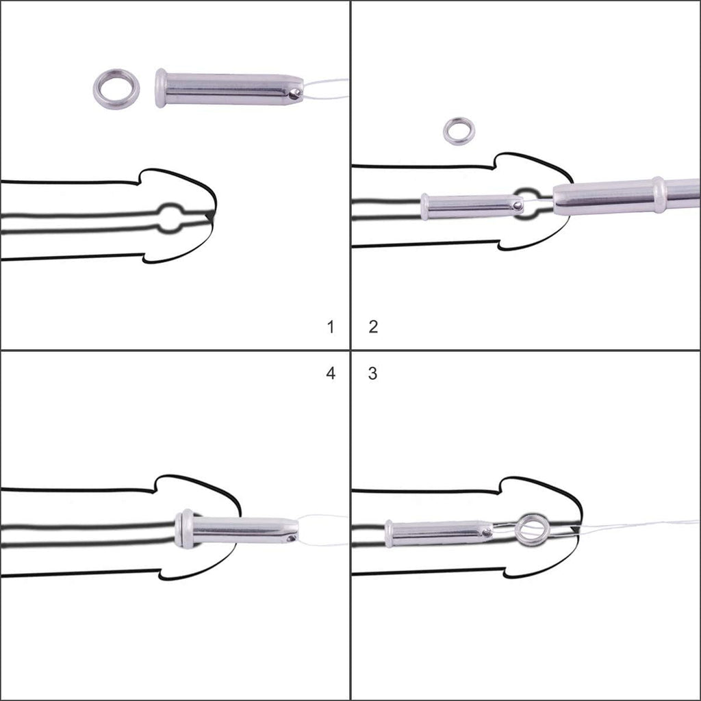Embedded Stainless Steel Urethral Plug Size 10mm-17mm