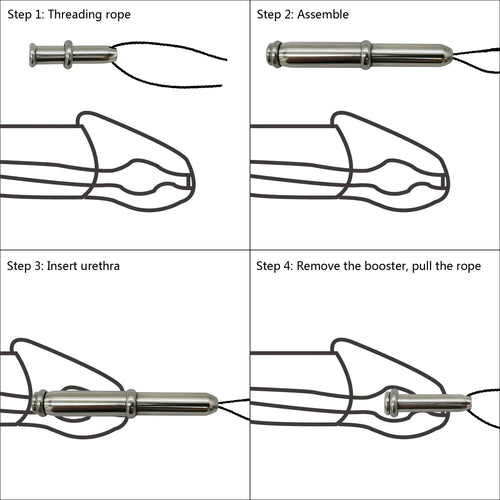 Embedded Stainless Steel Urethral Plug Size 10mm-17mm
